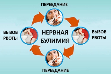 Лечение булимии в Нижнеудинске